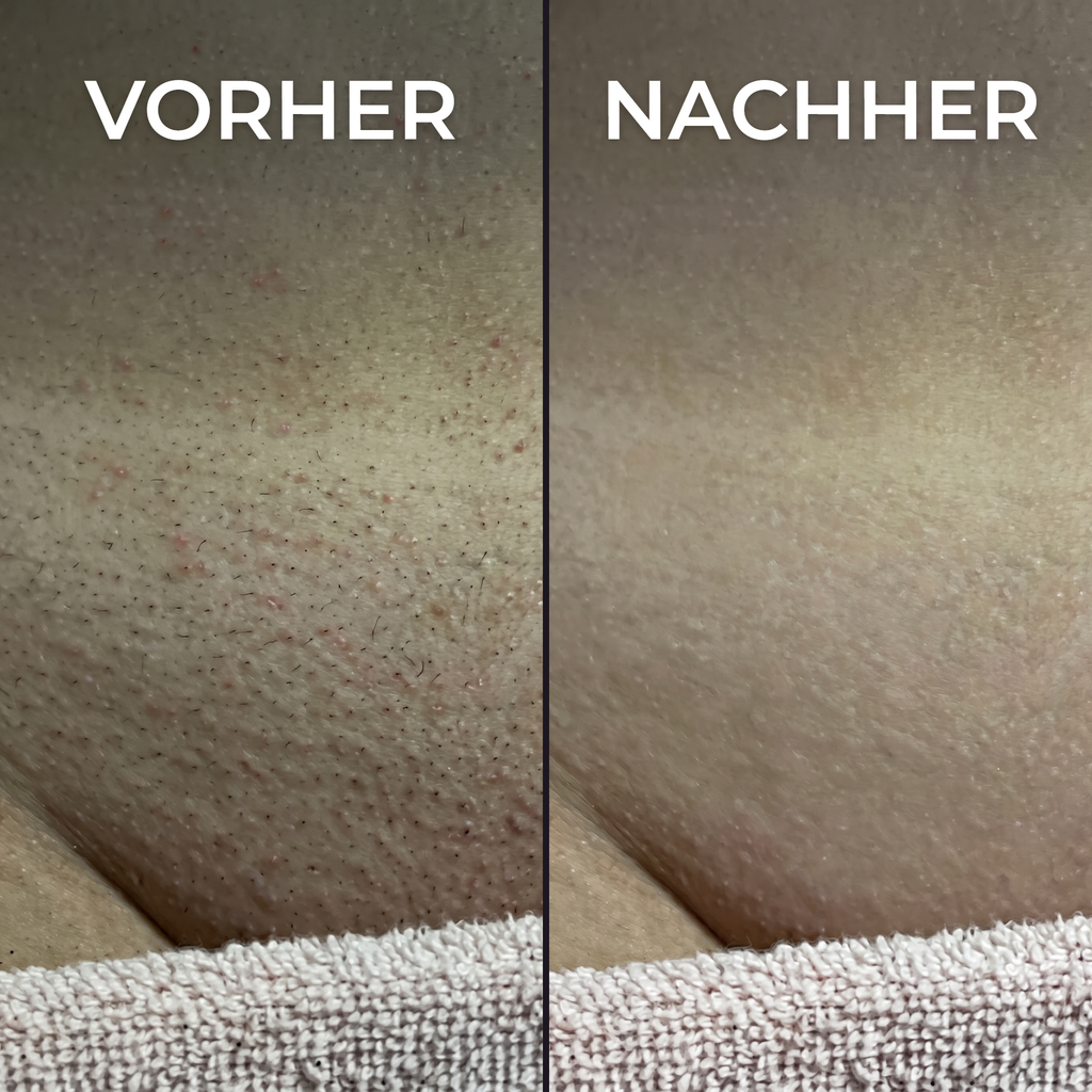 Pflanzlicher Haarwuchsstopp