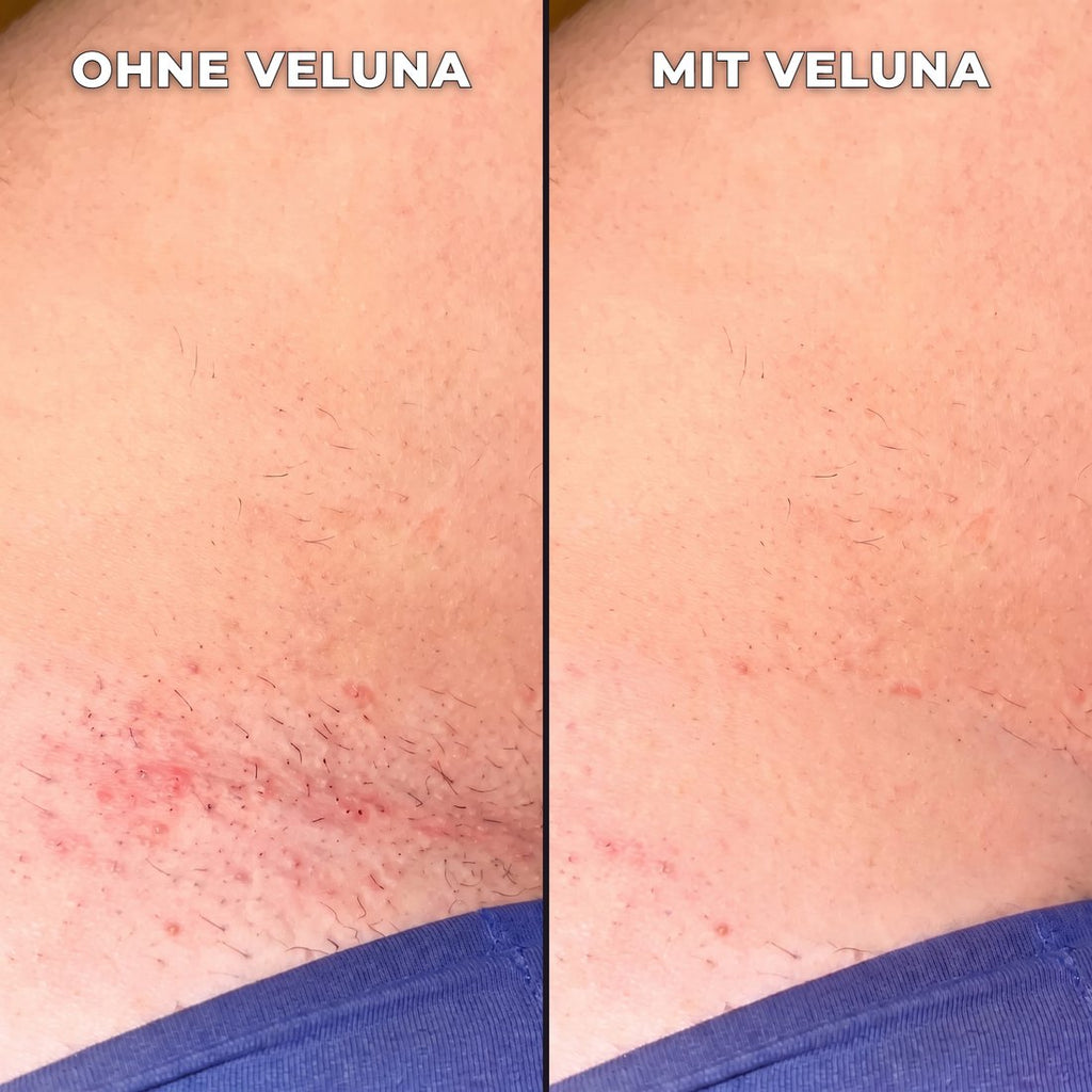 Pflanzlicher Haarwuchsstopp.