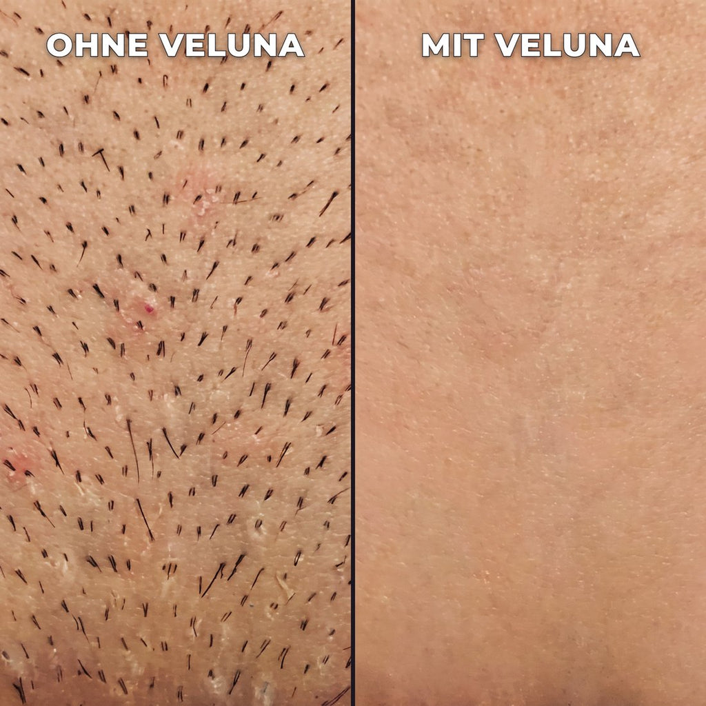 Pflanzlicher Haarwuchsstopp.