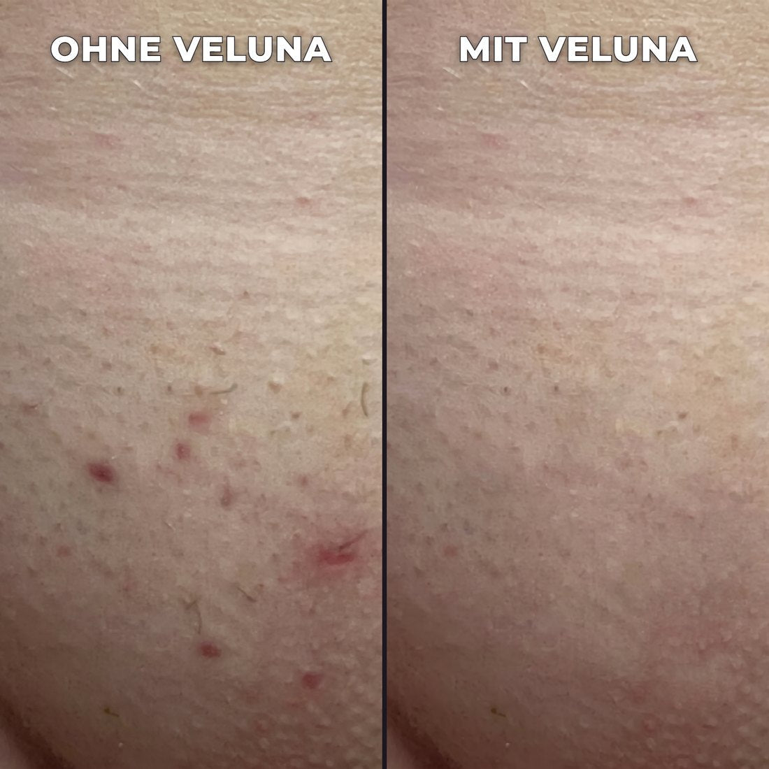 Pflanzlicher Haarwuchsstopp.