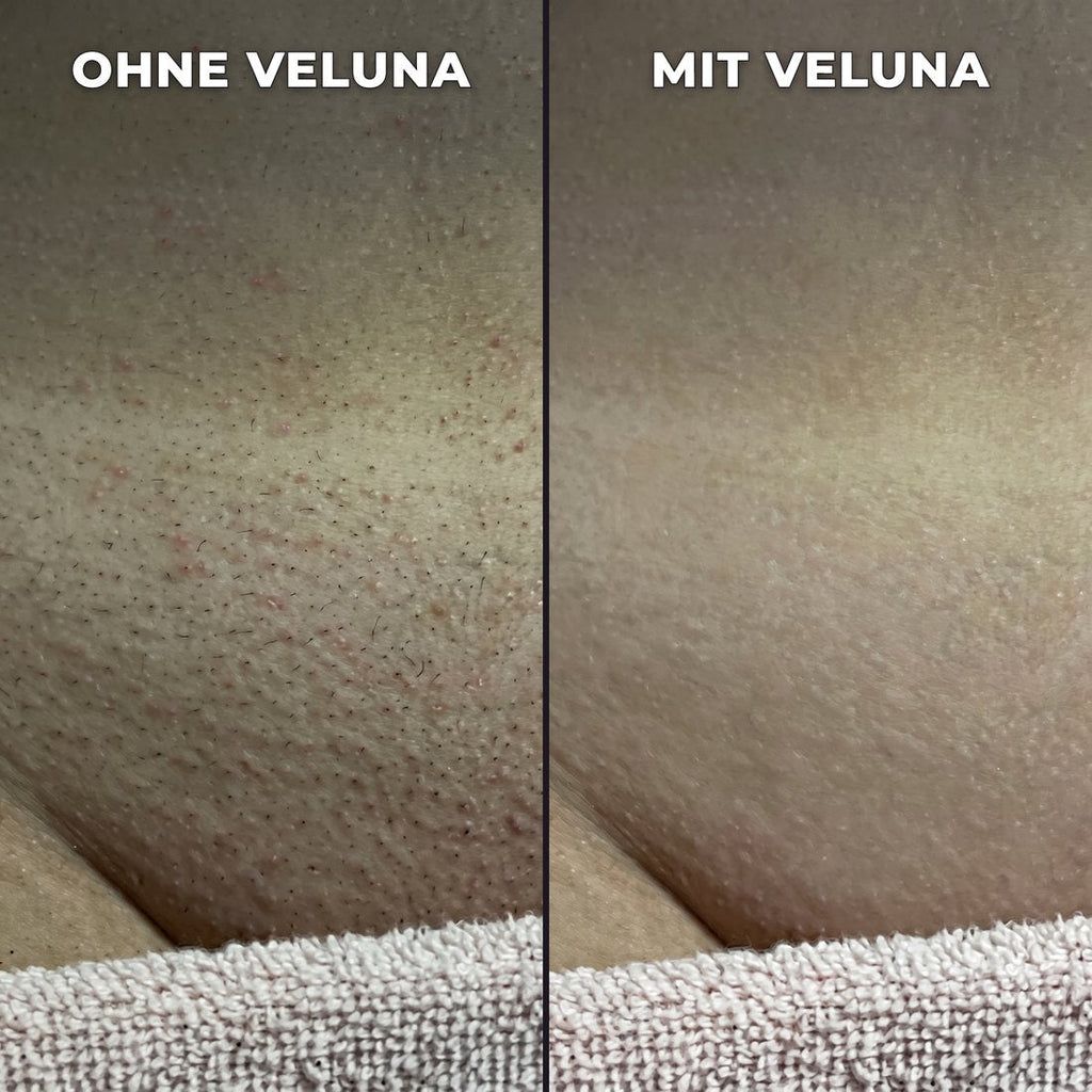Pflanzlicher Haarwuchsstopp.