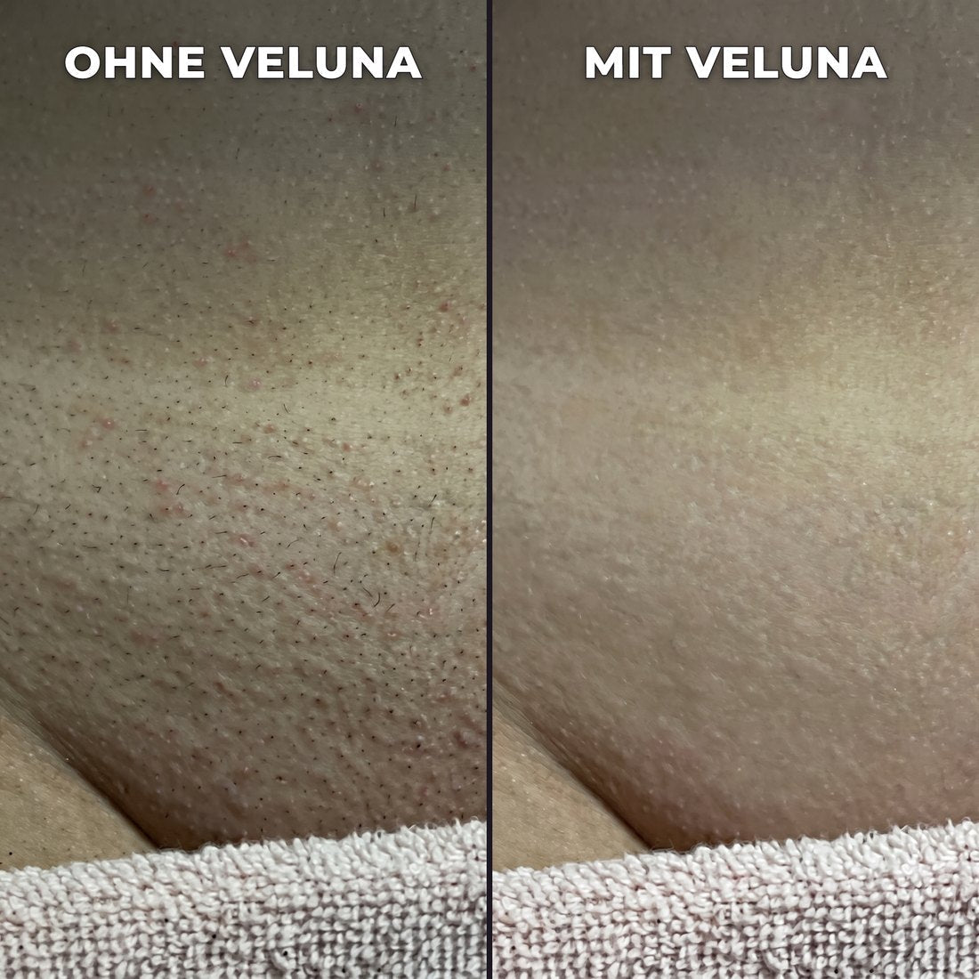 Pflanzlicher Haarwuchsstopp.