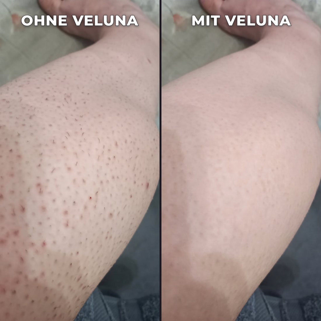 Pflanzlicher Haarwuchsstopp.