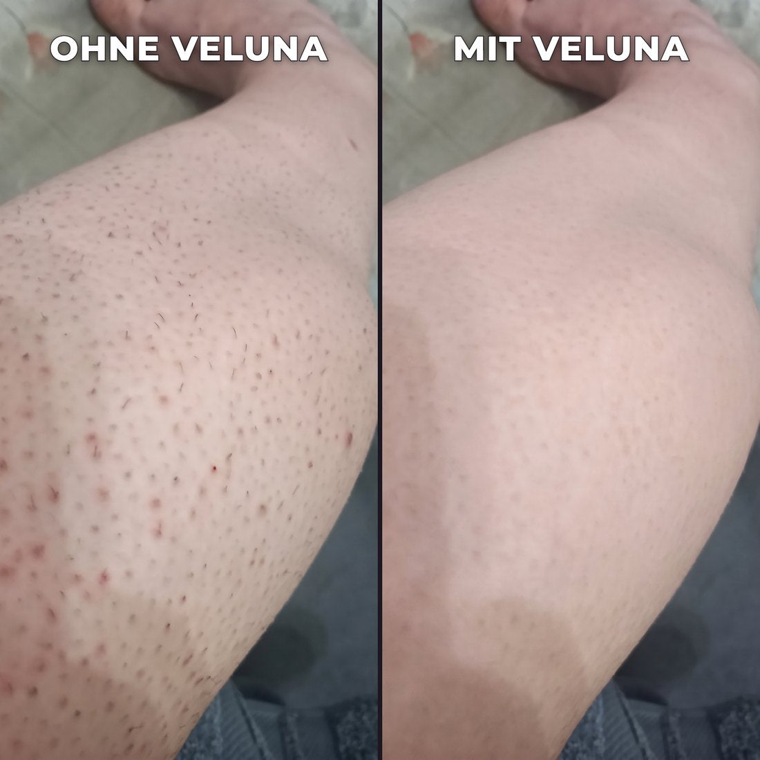 Pflanzlicher Haarwuchsstopp.
