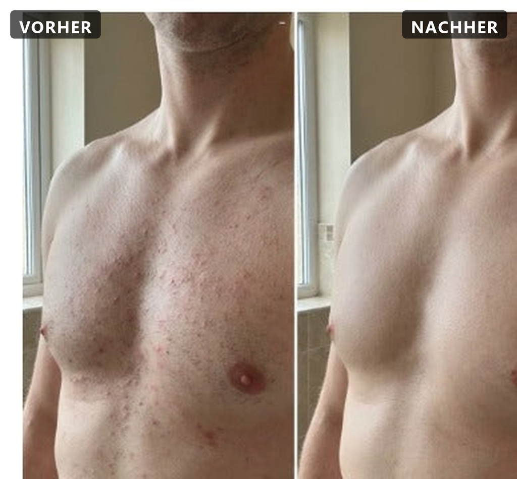 Pflanzlicher Haarwuchsstopp
